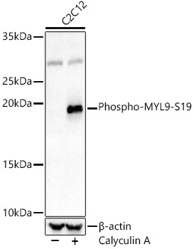 Phospho-MYL9-S19 Rabbit pAb