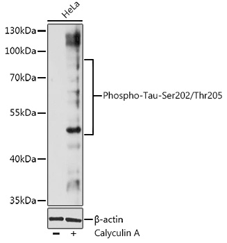 Phospho-Tau-Ser202/Thr205 Rabbit pAb