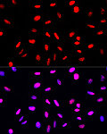 Western blot - Phospho-Histone H3-S10/T11 Rabbit pAb (AP0896)