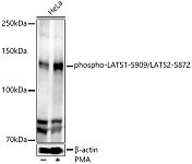 Western blot - phospho-LATS1-S909/LATS2-S872 Rabbit pAb (AP0904)