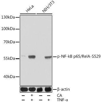 Phospho-NF-kB p65/RelA-S529 Rabbit pAb