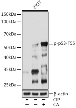 Phospho-p53-T55 Rabbit mAb