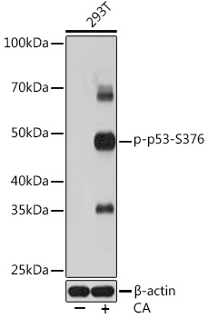 Phospho-p53-S376 Rabbit mAb