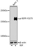 Western blot - Phospho-EGFR-Y1173 Rabbit mAb (AP0992)