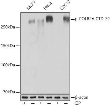 Phospho-POLR2A CTD-S2 Rabbit monoclonal antibody