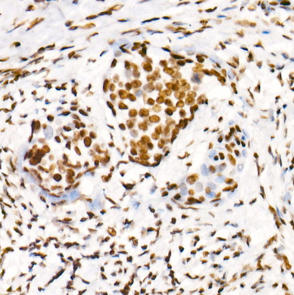 Phospho-POLR2A CTD-S2 Rabbit monoclonal antibody