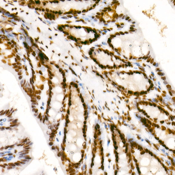 Phospho-POLR2A CTD-S2 Rabbit monoclonal antibody