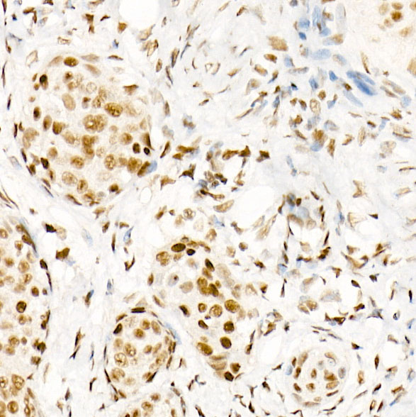 Phospho-POLR2A CTD-S5 Rabbit monoclonal antibody