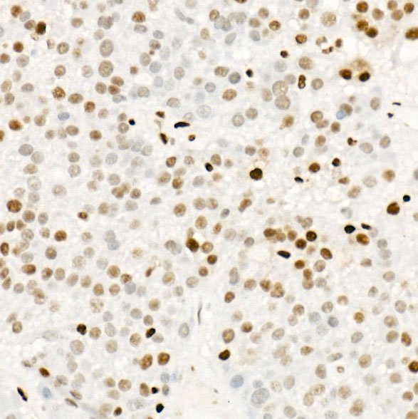 Phospho-POLR2A CTD-S5 Rabbit monoclonal antibody