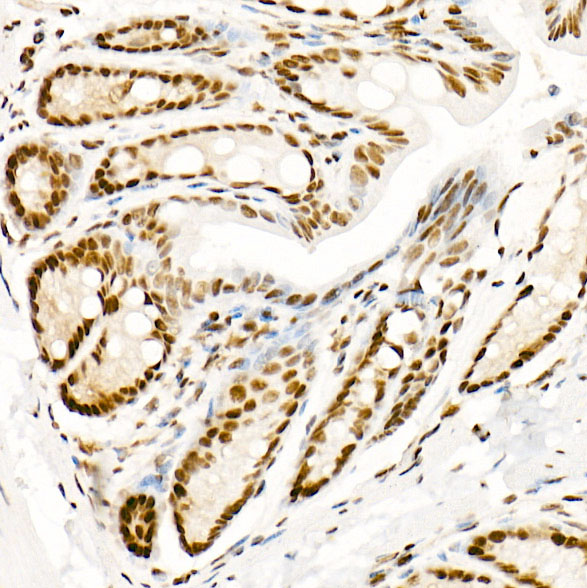 Phospho-POLR2A CTD-S5 Rabbit monoclonal antibody