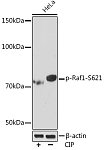 Western blot - Phospho-Raf1-S621 Rabbit mAb (AP1011)