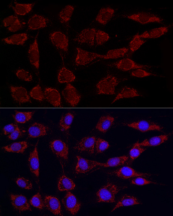 Phospho-PDHA1-S293 Rabbit monoclonal antibody