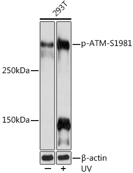 Phospho-ATM-S1981 Rabbit monoclonal antibody