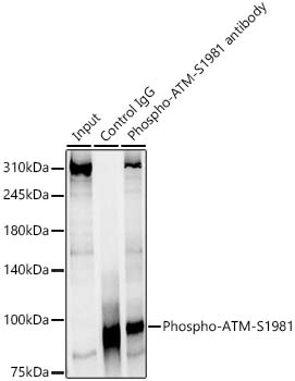 Phospho-ATM-S1981 Rabbit monoclonal antibody