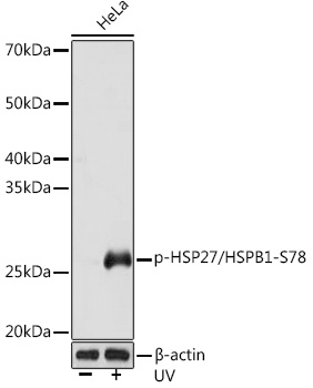 Phospho-HSP27/HSPB1-S78 Rabbit mAb