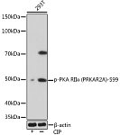 Western blot - Phospho-PKA RIIα (PRKAR2A)-S99 Rabbit mAb (AP1034)