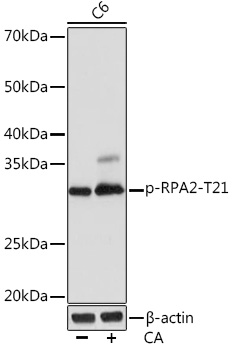 Phospho-RPA2-T21 Rabbit mAb