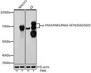 Western blot - Phospho-PAK4/PAK5/PAK6-S474/S560/S602 Rabbit mAb (AP1049)