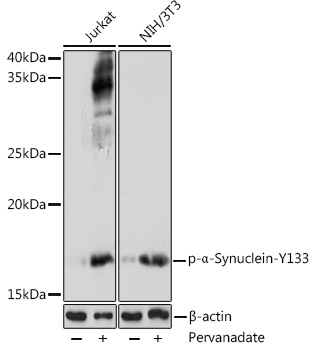 Phospho-α-Synuclein-Y133 Rabbit pAb