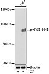 Western blot - Phospho-GYS1-S641 Rabbit mAb (AP1129)