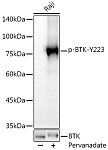Western blot - Phospho-BTK-Y223 Rabbit mAb (AP1136)