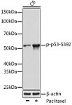 Western blot - Phospho-p53-S392 Rabbit mAb (AP1137)