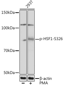 Phospho-HSF1-S326 Rabbit mAb