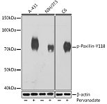 Western blot - Phospho-Paxillin-Y118 Rabbit mAb (AP1156)