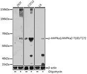 Western blot - Phospho-AMPKa1/AMPKa2-T183/T172 Rabbit pAb (AP1171)