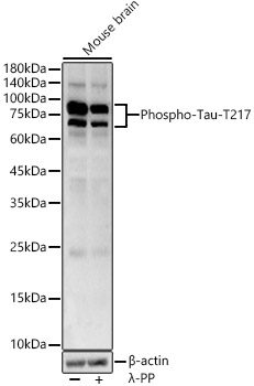 Phospho-Tau-T217 Rabbit pAb
