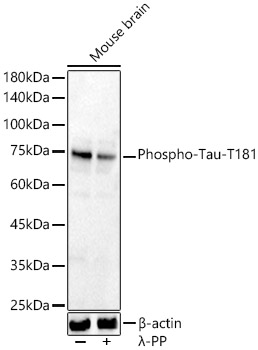 Phospho-Tau-T181 Rabbit pAb