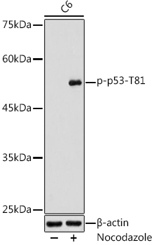 Phospho-p53-T81  Rabbit pAb