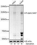 Western blot - Phospho-ULK1-S467 Rabbit pAb (AP1262)