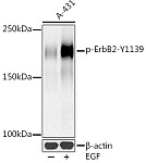 Western blot - Phospho-HER2/ErbB2-Y1139 Rabbit mAb (AP1285)