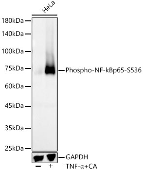 Phospho-NF-kB p65/RelA-S536 Rabbit mAb