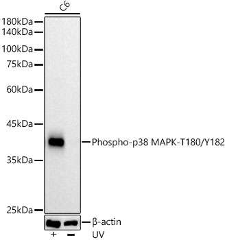 Phospho-p38 MAPK-T180/Y182 Rabbit monoclonal antibody
