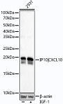 Western blot - Phospho-eIF4EBP1-S65 Rabbit mAb (AP1313)