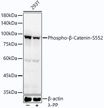 Phospho-β-Catenin-S552 Rabbit mAb