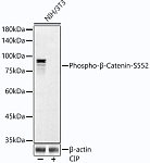 Western blot - Phospho-β-Catenin-S552 Rabbit mAb (AP1315)