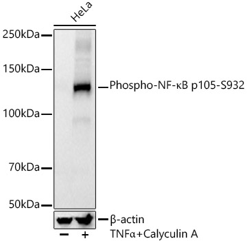 Phospho-NF-κB p105-S932 Rabbit mAb