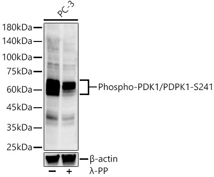Phospho-PDK1/PDPK1-S241 Rabbit mAb