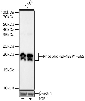 Phospho-eIF4EBP1-S65 Rabbit monoclonal antibody
