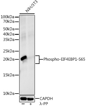 Phospho-eIF4EBP1-S65 Rabbit monoclonal antibody