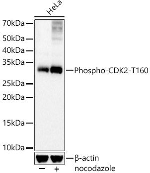 Phospho-CDK2-T160 Rabbit monoclonal antibody