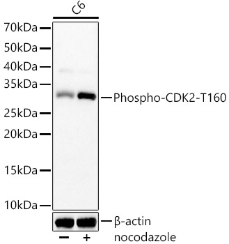 Phospho-CDK2-T160 Rabbit monoclonal antibody