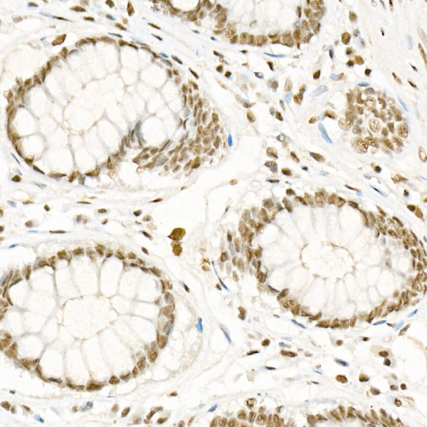 Phospho-CDK2-T160 Rabbit monoclonal antibody