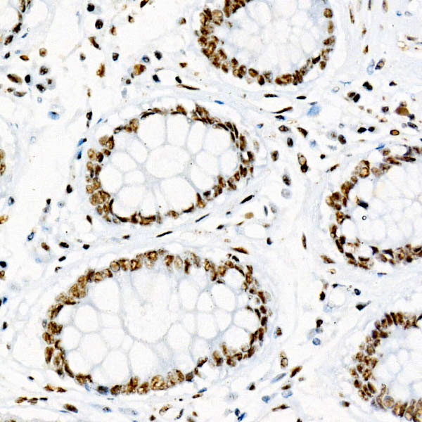 Phospho-p38 MAPK-T180 Rabbit pAb-Phospho-specific Antibodies