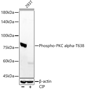Phospho-PKC alpha-T638 Rabbit mAb
