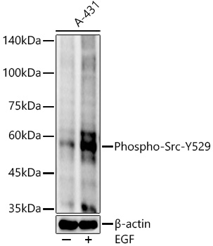 Phospho-Src-Y529 Rabbit mAb