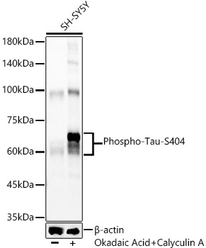 Phospho-Tau-S404 Rabbit mAb